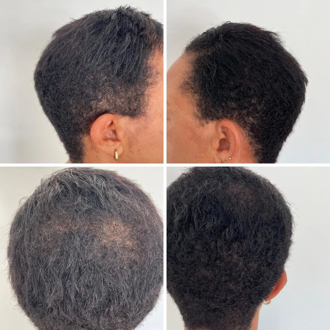 transformation pousse des cheveux texturés grâce aux compléments Karu